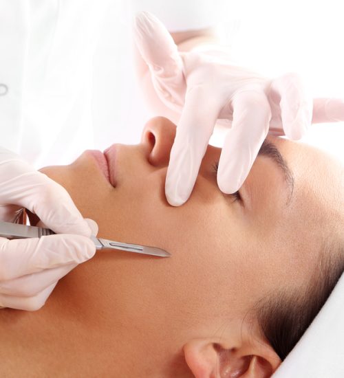 Dermaplaning